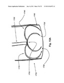 STEERING ENGAGEMENT CATHETER DEVICES, SYSTEMS, AND METHODS diagram and image