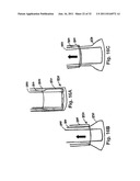 STEERING ENGAGEMENT CATHETER DEVICES, SYSTEMS, AND METHODS diagram and image