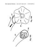 STEERING ENGAGEMENT CATHETER DEVICES, SYSTEMS, AND METHODS diagram and image