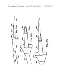 STEERING ENGAGEMENT CATHETER DEVICES, SYSTEMS, AND METHODS diagram and image