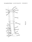 STEERING ENGAGEMENT CATHETER DEVICES, SYSTEMS, AND METHODS diagram and image