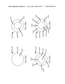 STEERING ENGAGEMENT CATHETER DEVICES, SYSTEMS, AND METHODS diagram and image