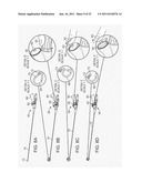 CATHETER ORIENTATION CONTROL SYSTEM MECHANISMS diagram and image