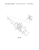 CATHETER ORIENTATION CONTROL SYSTEM MECHANISMS diagram and image