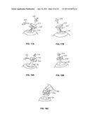 CATHETER ORIENTATION CONTROL SYSTEM MECHANISMS diagram and image