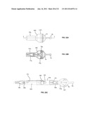 CATHETER ORIENTATION CONTROL SYSTEM MECHANISMS diagram and image