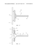 SHEATH INTRODUCTION APPARATUS AND METHOD diagram and image