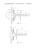 SHEATH INTRODUCTION APPARATUS AND METHOD diagram and image