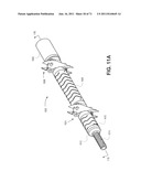 Fracture Fixation Device, Tools and Methods diagram and image