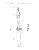 Fracture Fixation Device, Tools and Methods diagram and image