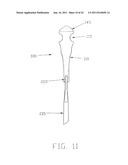 APPARATUS AND METHOD FOR RECONSTRUCTING A LIGAMENT diagram and image