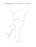 APPARATUS AND METHOD FOR RECONSTRUCTING A LIGAMENT diagram and image