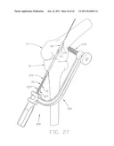 APPARATUS AND METHOD FOR RECONSTRUCTING A LIGAMENT diagram and image