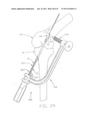 APPARATUS AND METHOD FOR RECONSTRUCTING A LIGAMENT diagram and image