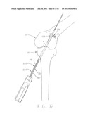 APPARATUS AND METHOD FOR RECONSTRUCTING A LIGAMENT diagram and image