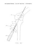 APPARATUS AND METHOD FOR RECONSTRUCTING A LIGAMENT diagram and image