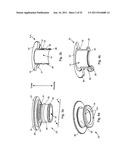 Coring Knife diagram and image