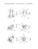 Coring Knife diagram and image