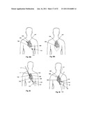 Coring Knife diagram and image