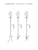 Coring Knife diagram and image