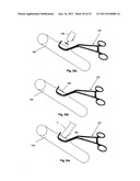 Coring Knife diagram and image