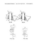 Coring Knife diagram and image