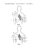 Coring Knife diagram and image