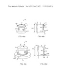 Coring Knife diagram and image