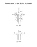 Coring Knife diagram and image