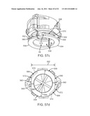 Coring Knife diagram and image