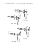 Coring Knife diagram and image