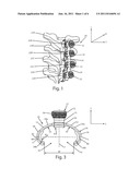 BONE FIXATION ASSEMBLY diagram and image