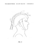 LOW LEVEL LIGHT THERAPY FOR ENHANCEMENT OF NEUROLOGIC FUNCTION BY ALTERING     AXONAL TRANSPORT RATE diagram and image