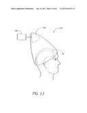 LOW LEVEL LIGHT THERAPY FOR ENHANCEMENT OF NEUROLOGIC FUNCTION BY ALTERING     AXONAL TRANSPORT RATE diagram and image