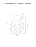 LOW LEVEL LIGHT THERAPY FOR ENHANCEMENT OF NEUROLOGIC FUNCTION BY ALTERING     AXONAL TRANSPORT RATE diagram and image