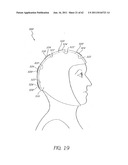 LOW LEVEL LIGHT THERAPY FOR ENHANCEMENT OF NEUROLOGIC FUNCTION BY ALTERING     AXONAL TRANSPORT RATE diagram and image