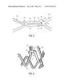 ENDOPROSTHESIS HAVING STRUTS LINKED BY FOOT EXTENSIONS diagram and image