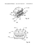 Prosthetic intervertebral discs assemblies having compressible core     elements with enhanced torque transmission diagram and image
