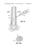 ARTIFICIAL JOINT SUPPORT BETWEEN FIRST AND SECOND BONES diagram and image