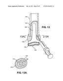 ARTIFICIAL JOINT SUPPORT BETWEEN FIRST AND SECOND BONES diagram and image