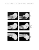 DYNAMIC BIOACTIVE BONE GRAFT MATERIAL HAVING AN ENGINEERED POROSITY diagram and image