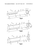 Allograft Bone Plugs, Systems and Techniques diagram and image