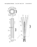 Allograft Bone Plugs, Systems and Techniques diagram and image