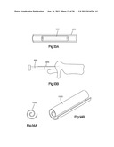 Allograft Bone Plugs, Systems and Techniques diagram and image