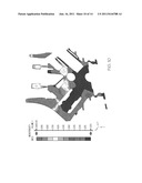 Method for simulating casting defects and microstructures of castings diagram and image