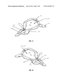 Hat with Adjustable Shading and Related Methods diagram and image