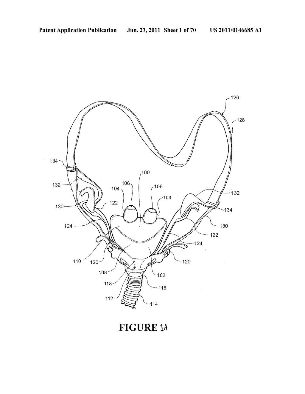 PATIENT  INTERFACE AND ASPECTS THEREOF - diagram, schematic, and image 02