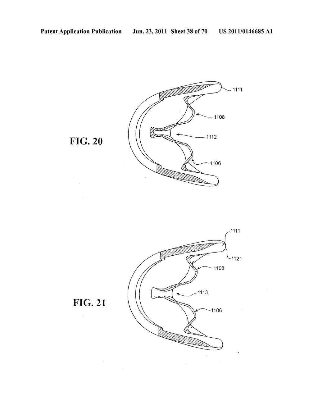 PATIENT  INTERFACE AND ASPECTS THEREOF - diagram, schematic, and image 39