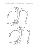 CUFFLESS TRACHEAL TUBE diagram and image