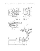 SUPRAGLOTTIC FIXATION DEVICE FOR ENDOTRACHEAL TUBES diagram and image